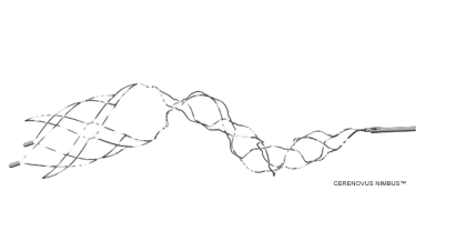 NIMBUS - geometric clot extractor