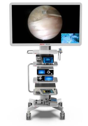 EnSight™ UBE System
