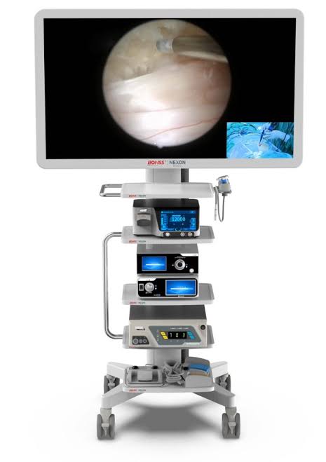 EnSight™ UBE System